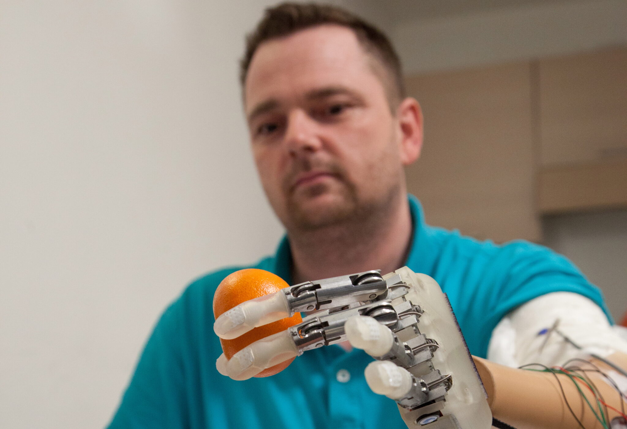 Врач делающий протезы. Датчанину Деннису Аабо.. Джесси Салливан бионические протезы. Современные протезы рук.