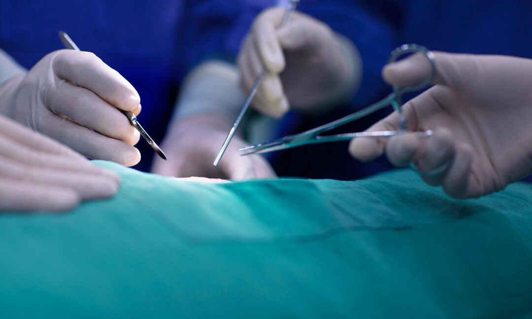händer med skyddshanskar håller i kirurgiska instrument över grönt kirurgpapper