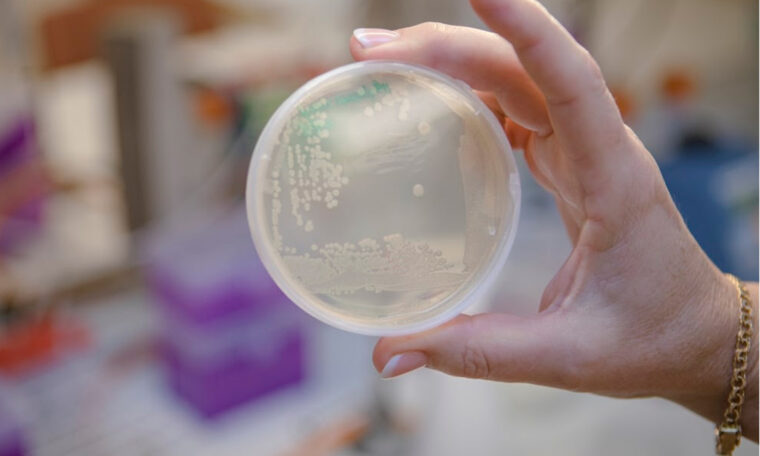 Hand håller fram agarplatta med bakterieodling